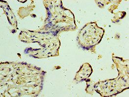 TRPV4 antibody