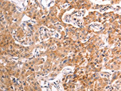 TRPV4 antibody