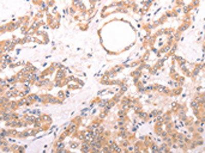 TRPV4 Antibody