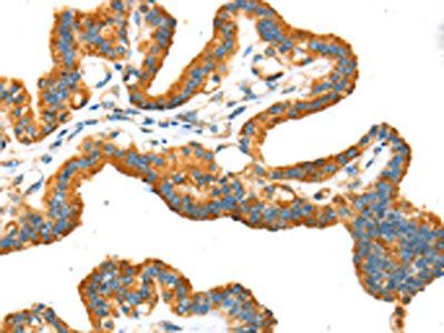 TRPV5 Antibody