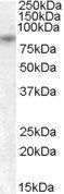 Goat anti-TRPV5 Antibody