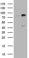 TRPV6 antibody