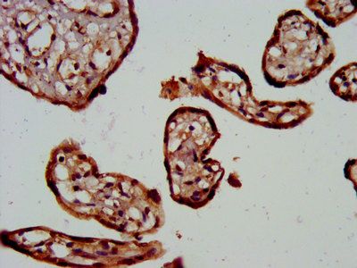 TRPV6 Antibody
