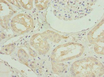 TXN Antibody