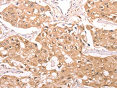 TXN Antibody