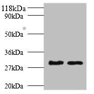 Tryptase beta-2 antibody