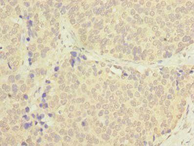 TSACC Antibody