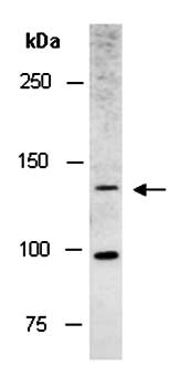 TSC1 (N) Antibody, Rabbit Polyclonal