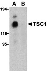 TSC1 Antibody
