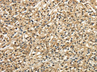 TSC22D1 Antibody