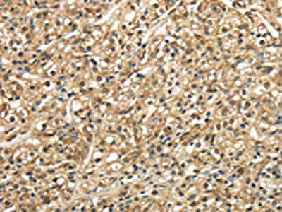 TSC22D1 antibody