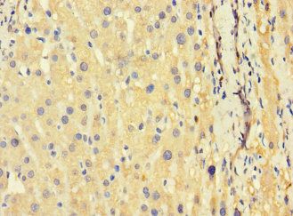 TSC22D3 Antibody