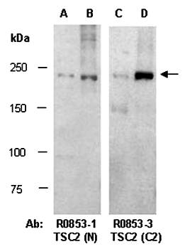 TSC2 (C2) Antibody, Rabbit Polyclonal