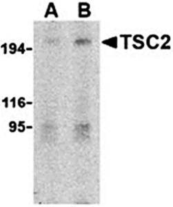 TSC2 Antibody