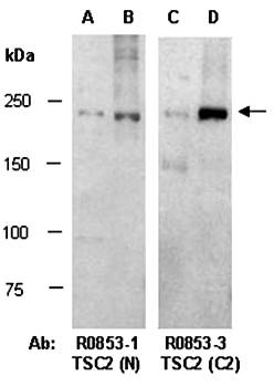 TSC2(vPairTM) Antibodies