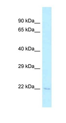 Tsen15 antibody