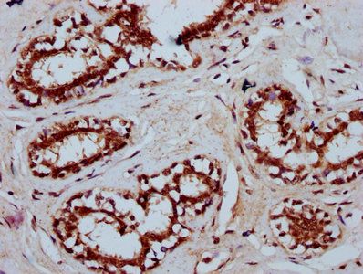 TSEN15 Antibody