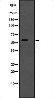 TSEN2 antibody