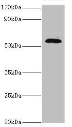 TSEN2 Antibody