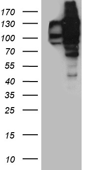 TSEN34 antibody
