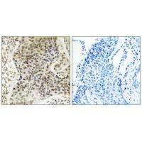 TSEN54 Antibody