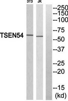 TSEN54 antibody