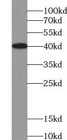 TSG-6 antibody