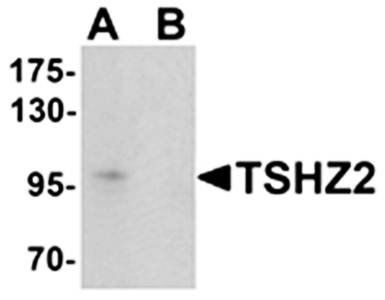 TSHZ2 Antibody