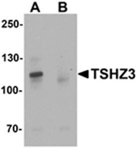 TSHZ3 Antibody