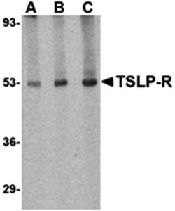 TSLP Receptor Antibody