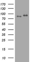 TSP50 (PRSS50) antibody