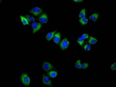 TSPAN18 antibody