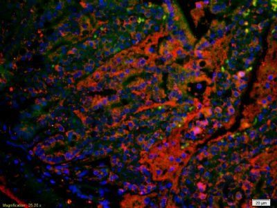 TSPAN20 Rabbit Polyclonal Antibody