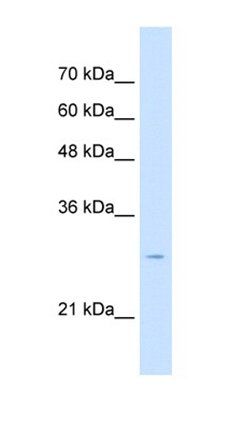TSPAN32 antibody