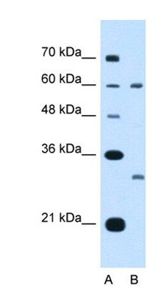 TSPAN32 antibody