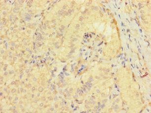 TSPAN32 Antibody