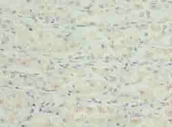 TSPAN33 Antibody