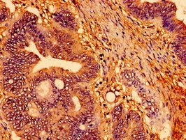 TSPO Antibody