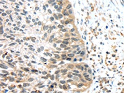 TSPY1/TSPY3 Antibody