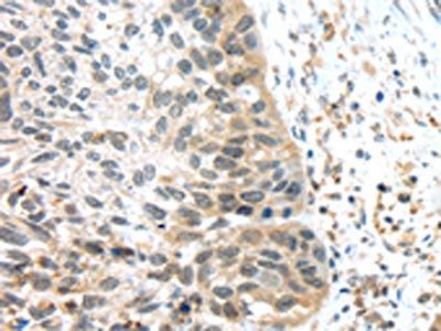 TSPY3 antibody