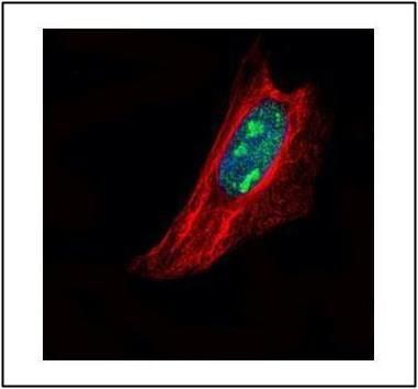 TSPYL1 Rabbit Polyclonal Antibody
