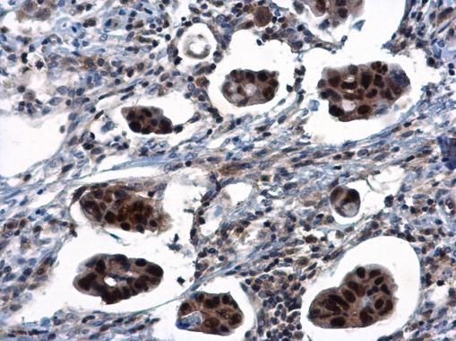 TSPYL1 Rabbit Polyclonal Antibody