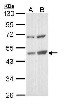 TSPYL1 Rabbit Polyclonal Antibody