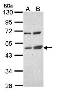 TSPYL1 antibody
