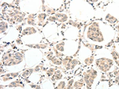 TSPYL2 Antibody