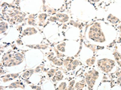 TSPYL2 antibody