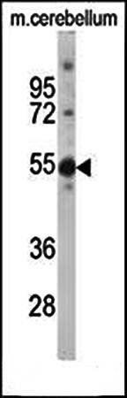 TSPYL5 antibody