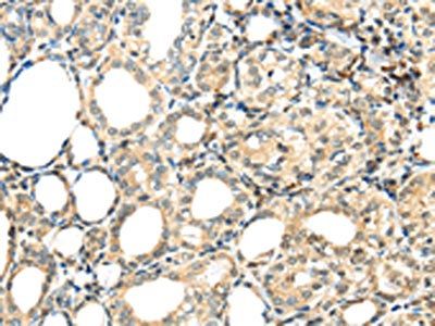 TSPYL6 Antibody