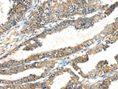TSPYL6 Antibody
