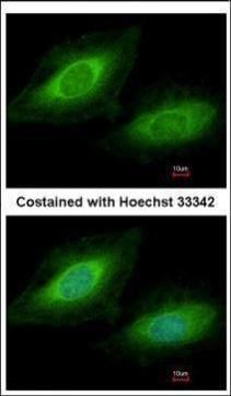 TSSC1 Rabbit Polyclonal Antibody